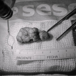 11. LO QUE EL CUERPO ESCONDE