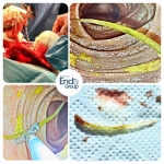 1. INTESTINO ESPINADO: ABORDAJE COMBINADO EN YEYUNO
