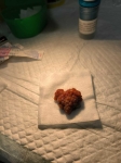 26. UN CORAZÓN EN EL COLON