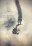 39. COILS. LA TRAMA QUE EVITA EL FATAL DESENLACE