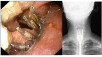 5. ENDOSCOPIAS EN PSIQUIATRIA